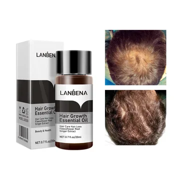Naujas Galingas Plaukų Augimo Serumas užkirsti Kelią Plaukų Slinkimas Skystis, Stabdžių-Alopecija Priežiūros Greičiau Auga Tankus Imbieras plaukų Aliejus 20ml Unisex