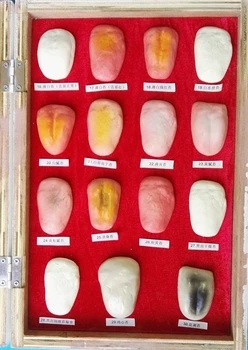 30 Rūšių Žmogaus Liežuvio Sužalojimas Modeliai Burnos Priežiūros Medicinos Mokymo Modelį Žmogaus Liežuvis Patologijos Modelis Medicinos Anatomijos Modeliai
