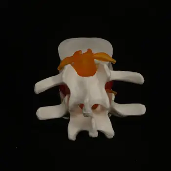 Žmogaus Juosmens Modelis Anatomijos Disko Herniation Mokytis Medicinos Pagalbos Instrume