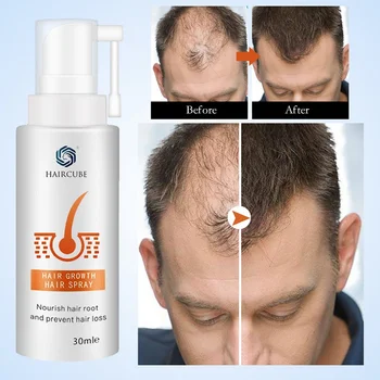 HAIRCUBE Stabdymo Stabdžių Plaukų Slinkimas Greitą Plaukų Augimą Produktai Vyrams Moters Plaukų Augimą Purškimo eterinis Aliejus Skystas Esmė Regeneracijos