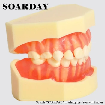 SOARDAY Standartinis Vaiko Pirminės Dantų Modelio Dantų Nuimamas Minkštas Gumos