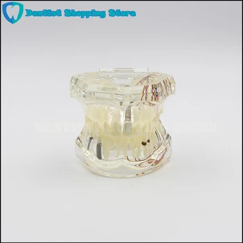 Dantų dantų modelio Skaidrios patologinių implantas nervų modelis Remonto modelio Mokymo demonstravimo modelis