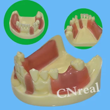 1 Gabalas, Dantų Implantai Praktikos Dantų Modelį su Imitacija Kaulų (Gręžimo) & Silikono Minkšta Guma (Pjovimo/Siuvimo)