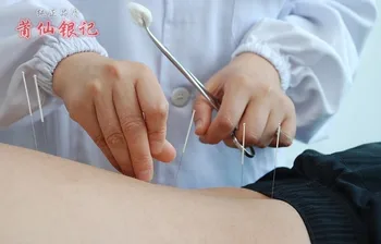 1pcs Kinų medicinos sidabro akupunktūros adatos 999 kojų sidabro Prevencijos alergijos