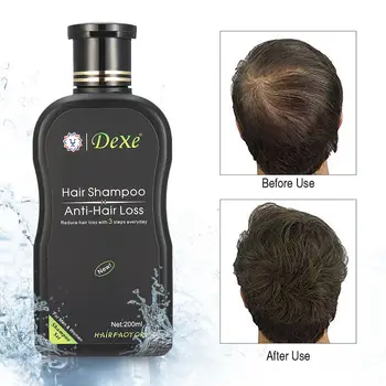 Plaukų Priežiūra Dexe Plaukų slinkimo Plaukų Šampūnas Nustatyti Kinų Žolelių Plaukų Augimą Produkto Išvengti Plaukų Gydymas, Vyrų ir Moterų 200ml