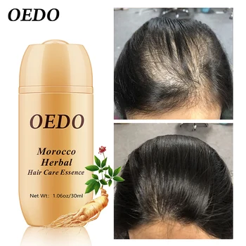 30ML Maroko Plaukų Slinkimas Gydymo Ženšenis, Imbieras Plaukų Augimą Aliejaus Žolelių Sausų Plaukų Priežiūros Tipų Galvos odos Vaistažolių Gydymo Esmė