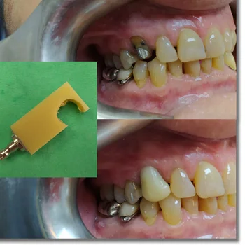 PMMA 15 vnt. Sirona19 dantų CAD CAM blokuoti 20 spalvų stomatologas karūna laikinas vainikėlis, tiltas