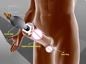 Varpos didintuvas vyrų seksualinės massager elektros šoko medicinos sekso žaislas, skirtas žmogus pro išsiplėtimo